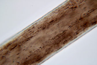 A joint project by the U.S. Department of Justice, the FBI, the New York-based Innocence Project and the National Association of Criminal Defense Lawyers is re-examining FBI analysts' testimony and findings in thousands of cases involving microscopic hair analysis. The FBI has acknowledged most of its analysts overstated the reliability of the technique more than 90 percent of the time. This is what hair looks like under a microscope. Photo courtesy of Microtrace LLC.