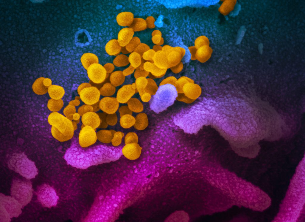 This scanning electron microscope image shows SARS-CoV-2 viruses (yellow) emerging from the surface of cells (blue and pink) cultured in the lab. The federal government has mandated significant biosafety precautions for researchers working with the virus. Image from the National Institute of Allergy and Infectious Diseases/Rocky Mountain Laboratories (CC BY 2.0).