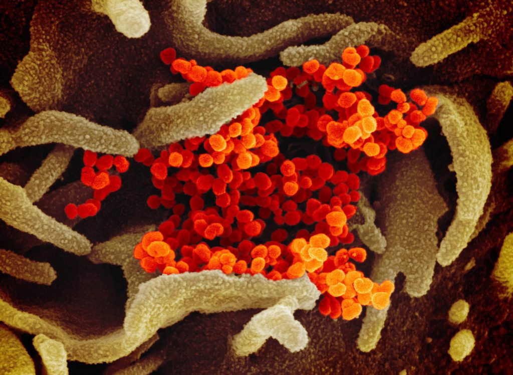 A scanning electron microscope image shows SARS-CoV-2 viruses (in orange) emerging from the surface of cells cultured in the lab. SARS-CoV-2, also known as 2019-nCoV, is the virus that causes COVID-19. The virus shown was isolated from a patient in the U.S. Image from the National Institute of Allergy and Infectious Diseases/Rocky Mountain Laboratories (CC BY 2.0).