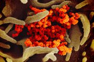 A scanning electron microscope image shows SARS-CoV-2 viruses (in orange) emerging from the surface of cells cultured in the lab. SARS-CoV-2, also known as 2019-nCoV, is the virus that causes COVID-19. The virus shown was isolated from a patient in the U.S. Image from the National Institute of Allergy and Infectious Diseases/Rocky Mountain Laboratories (CC BY 2.0).