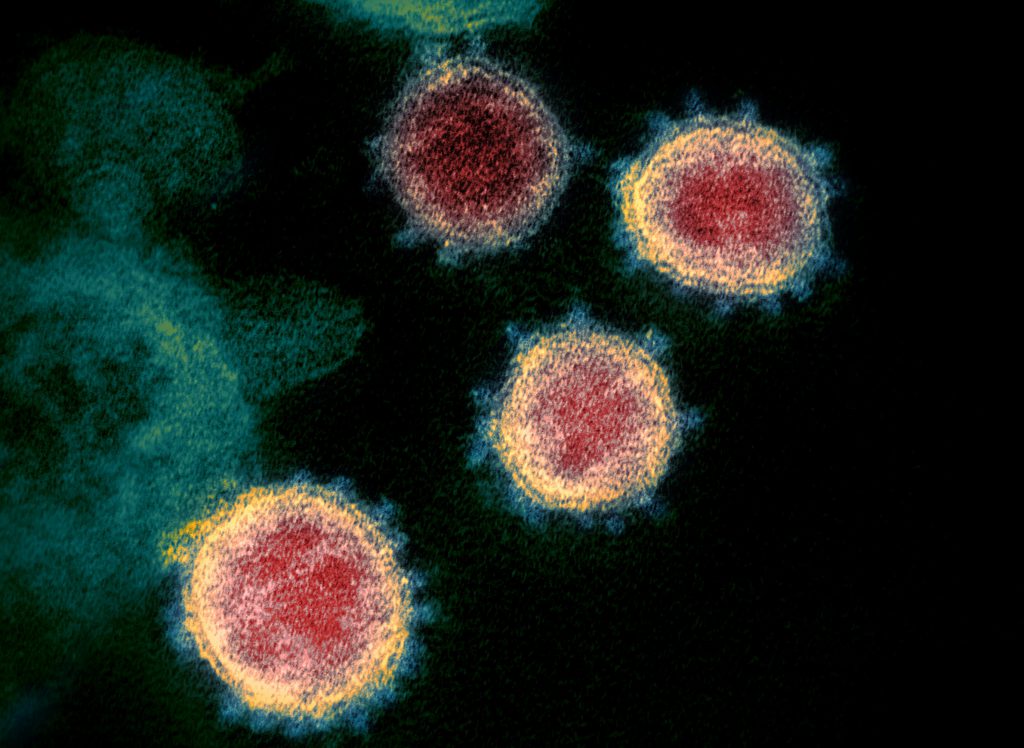 SARS-CoV-2. Image from the National Institute of Allergy and Infectious Diseases/Rocky Mountain Laboratories (CC BY 2.0).