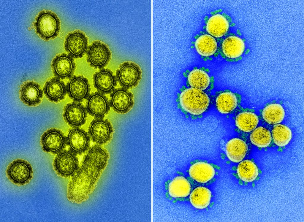 A pair of transmission electron microscope images depict color-enhanced H1N1 influenza (left) and SARS-CoV-2 (right) virus particles. The 1918 pandemic was caused by an H1N1 flu virus, but this image is of a different H1N1 strain imaged in 2013. The COVID-19 pandemic is caused by the SARS-CoV-2 novel coronavirus, with this image isolated from a patient in 2020. These two images may not be at the same scale. National Institute of Allergy and Infectious Diseases/CDC Public Health Image Library; National Institute of Allergy and Infectious Diseases (CC BY 2.0)