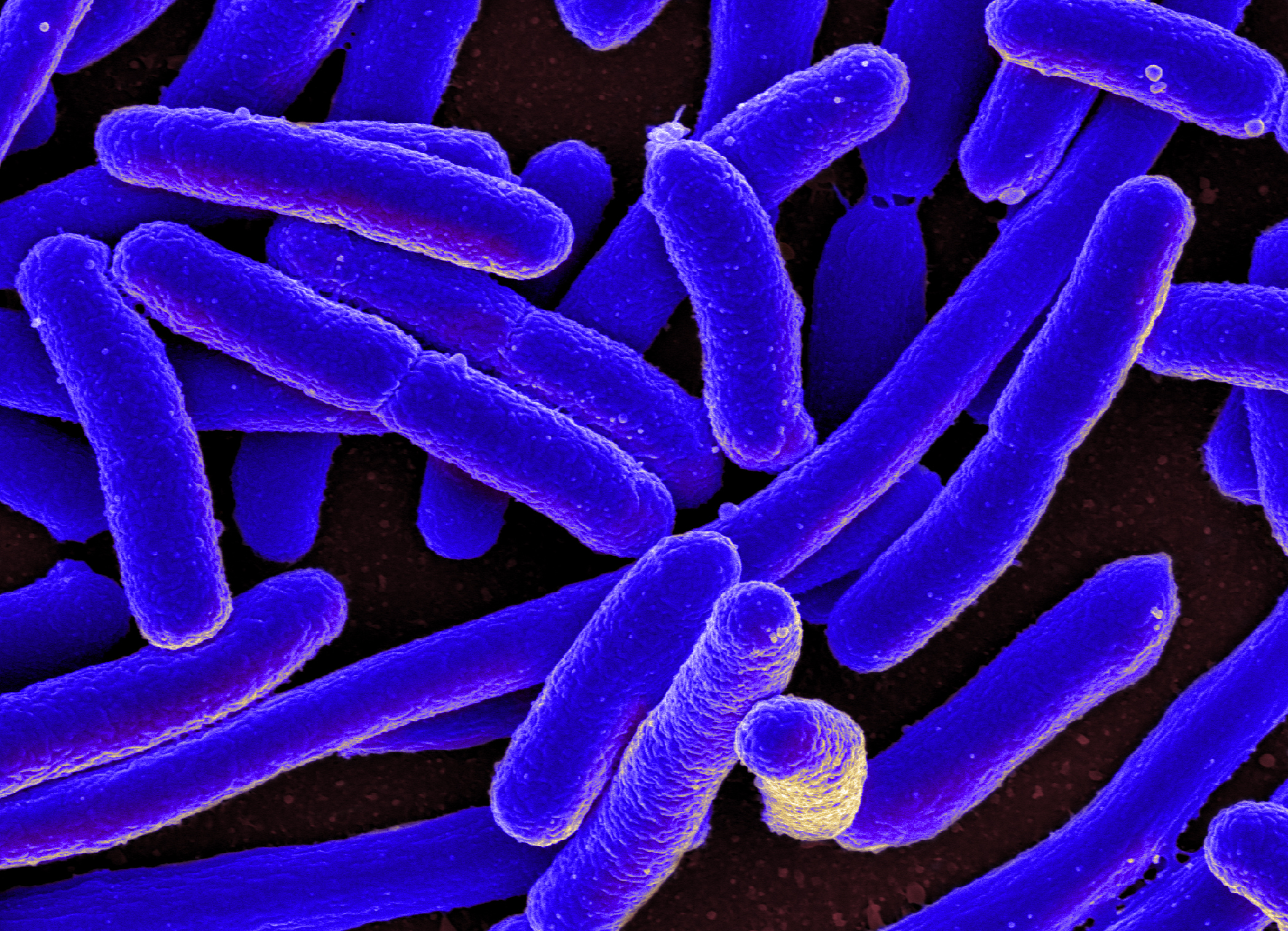 Colorized scanning electron micrograph of Escherichia coli, grown in culture and adhered to a cover slip. Photo by NIAID, CC BY 2.0 , via Wikimedia Commons