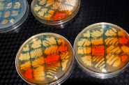 Petri dishes containing bacteria that scientists hope will lead to the discovery of new antibiotics. The petri dishes are different colors because they contain different growing mediums that make the bacteria multiply. Patricia Pointer/Wisconsin Institute for Discovery