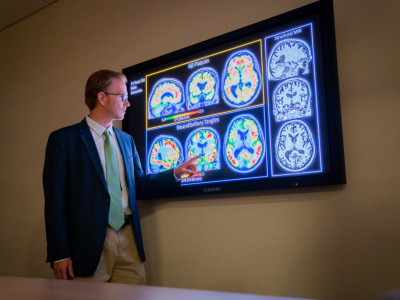 Wisconsin Researchers Launch First-of-its-Kind Alzheimer’s Study