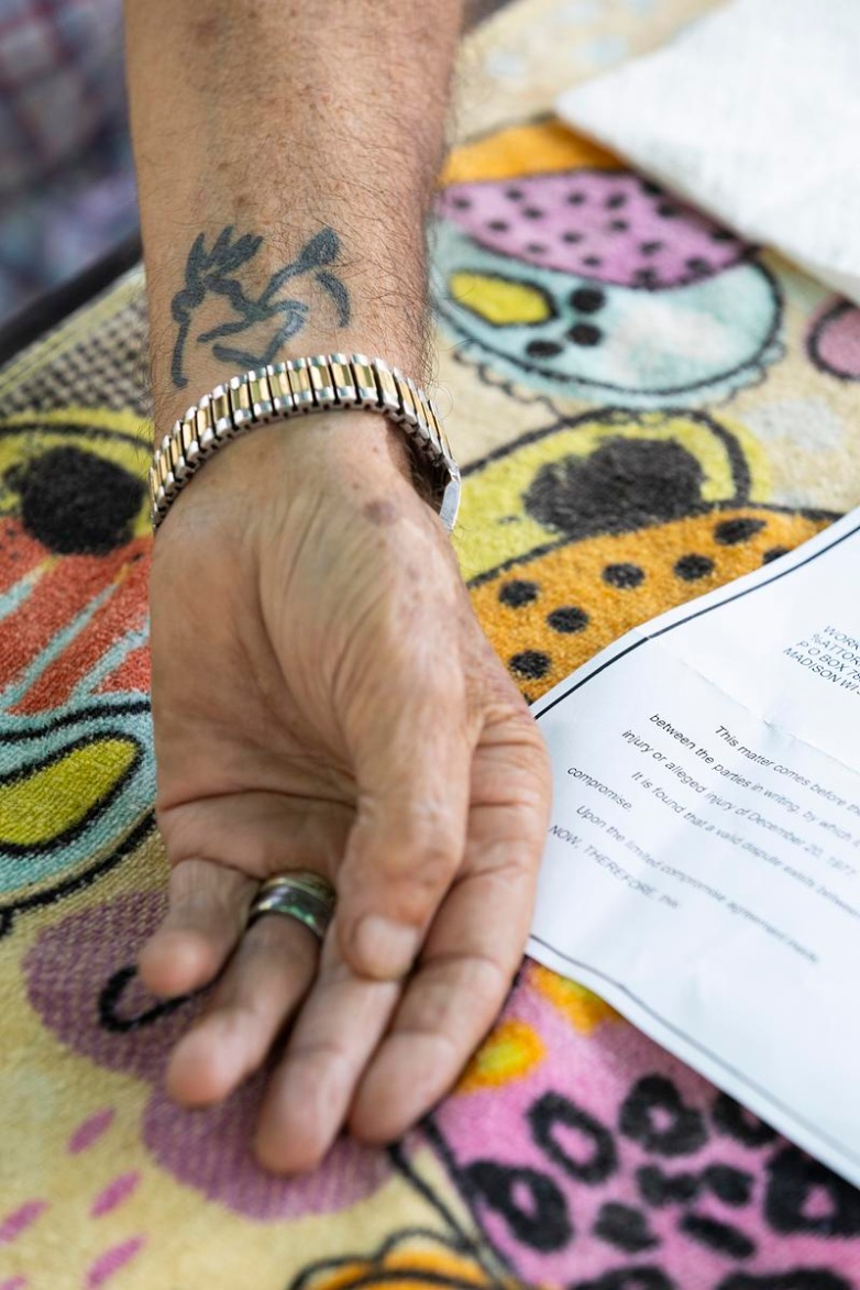 Jimmy Novy holds out his arm to show his new tattoo on July 29, 2025, in Hillsboro, Wis. He has been collecting worker’s comp checks from the state since his injury in his late 20s. (Joe Timmerman / Wisconsin Watch)
