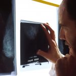 How One Wisconsin Family Helped Change Breast Screening Rules